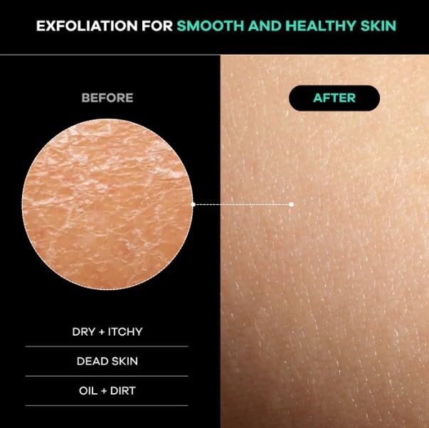 Dermasuri Deep Exfoliating Back Scrubber, Shower & Bath Back Exfoliator